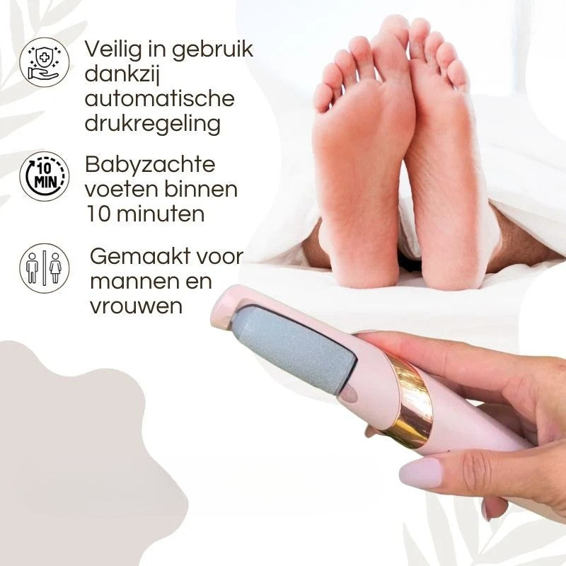 CallusMaster™ – Elektrische Eeltverwijderaar voor Zachte & Verzorgde Voeten | 50% KORTING