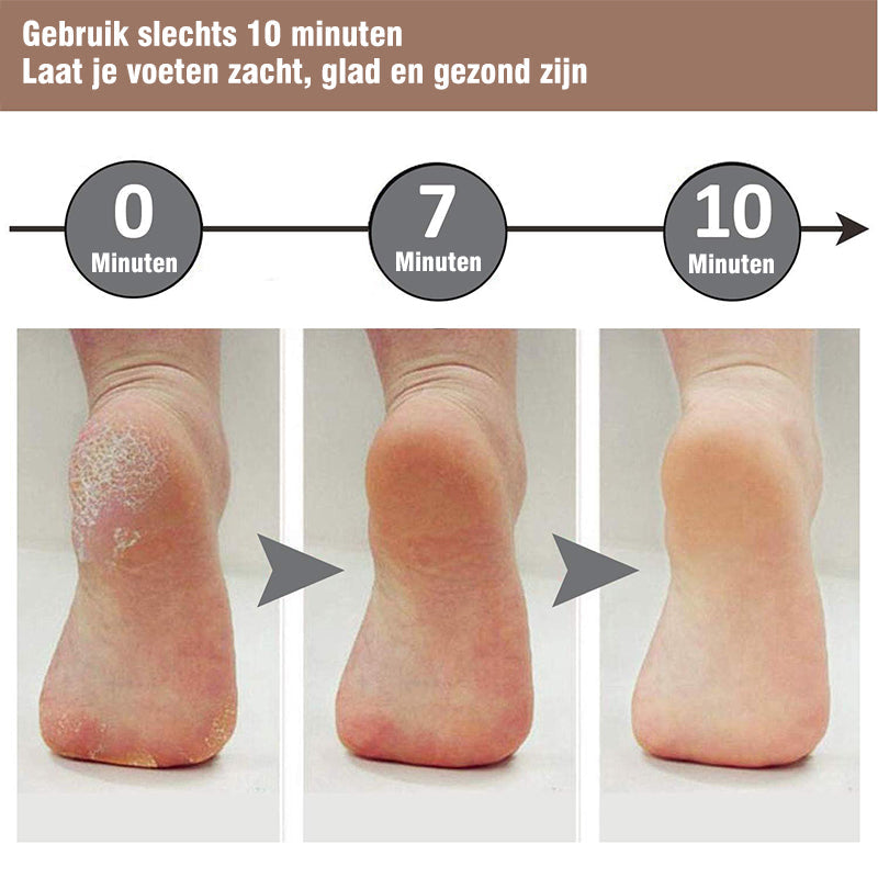 Pedicure Voet Bestand