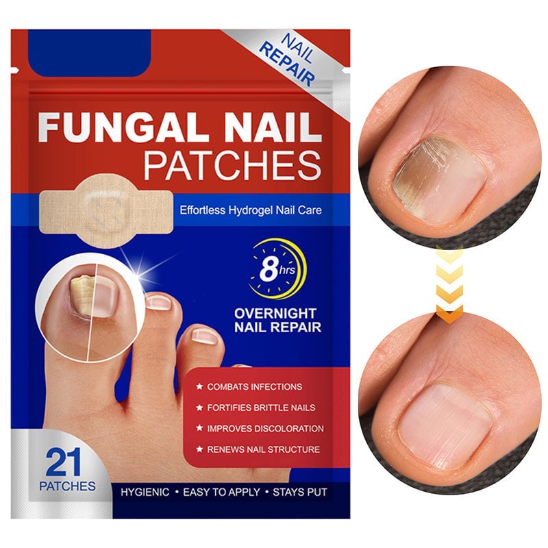 FungiPatch™ 60+60 stuks – Discrete Behandeling van Schimmelnagels | 50% KORTING