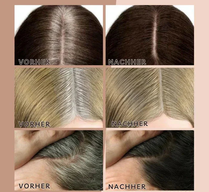 Altijd perfecte haarlijnen | 1+1 GRATIS