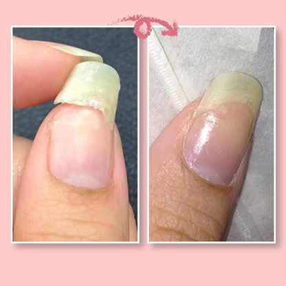 Beschermende gel voor nagelreparatie | 1+1 GRATIS