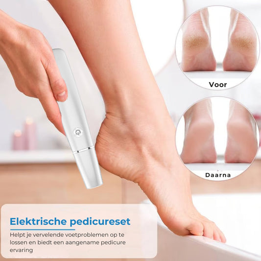 Elektrische eeltverwijderaar 🎁 Inclusief vervangende kop🎁