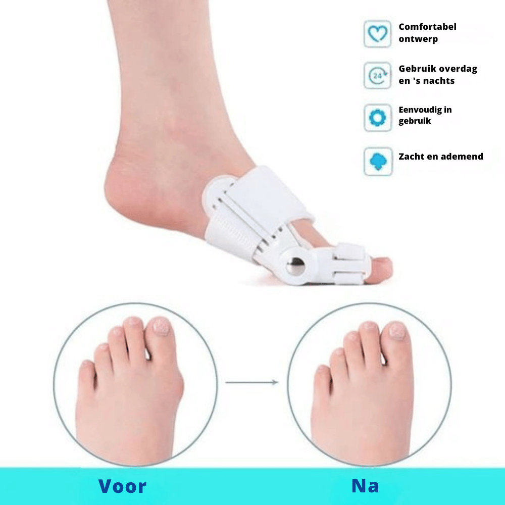 SoleAlign — Bunion Corrector voor Pijnvrije Voeten | 1+1 GRATIS