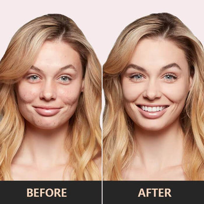 Driekleurige Concealer - Perfecte Kleurcorrectie & Huidverzorging
