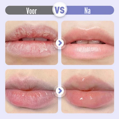 LumiLip – Opvullend Lippenserum | 1+2 GRATIS
