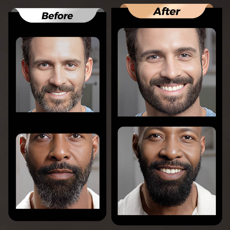 BeardMaster – Vollere Baard in Seconden | 1+2 GRATIS