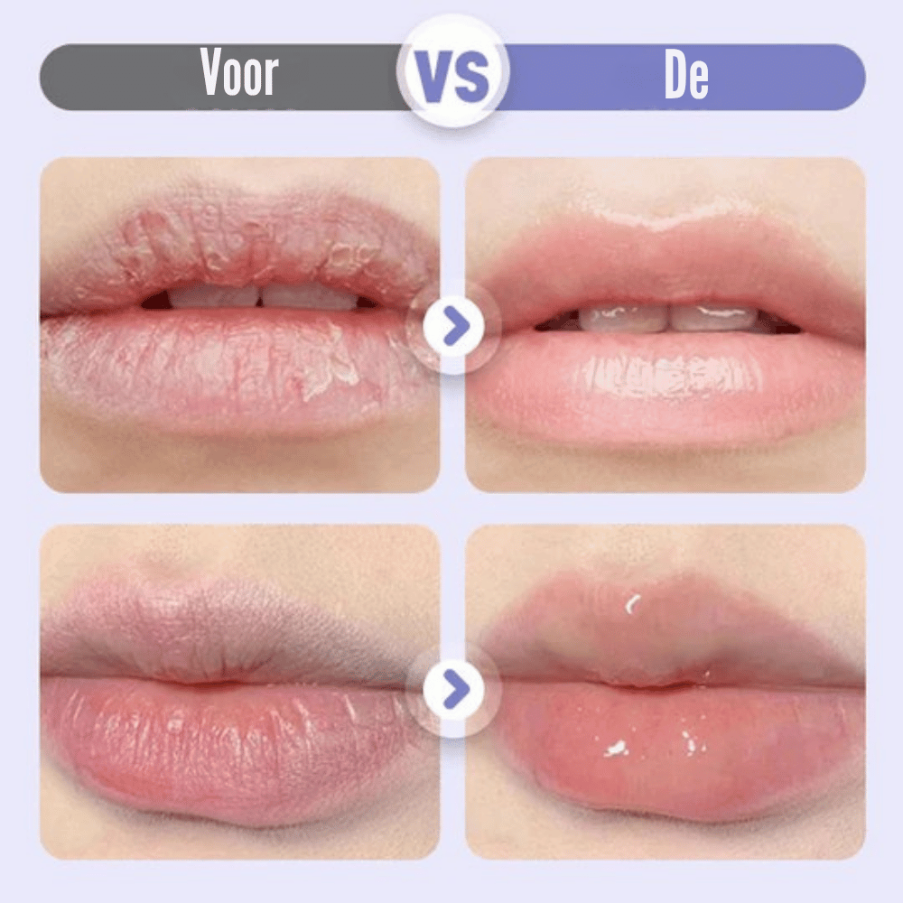 LushVive – Opvullend Lippenserum | 1+1 GRATIS