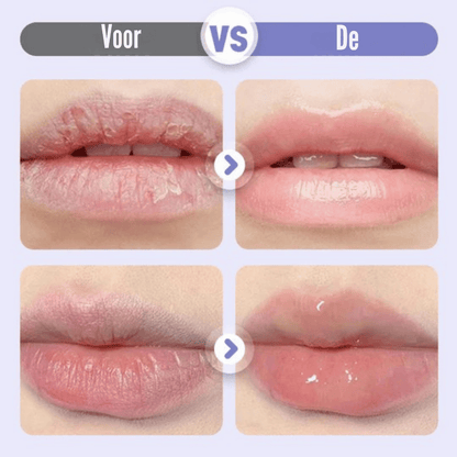 LushVive – Opvullend Lippenserum | 1+1 GRATIS