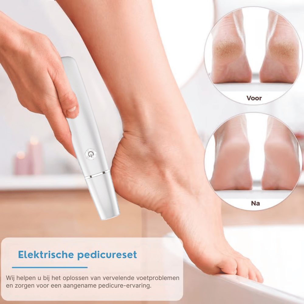 SilkStride — Elektrische Eeltverwijderaar | 50% KORTING