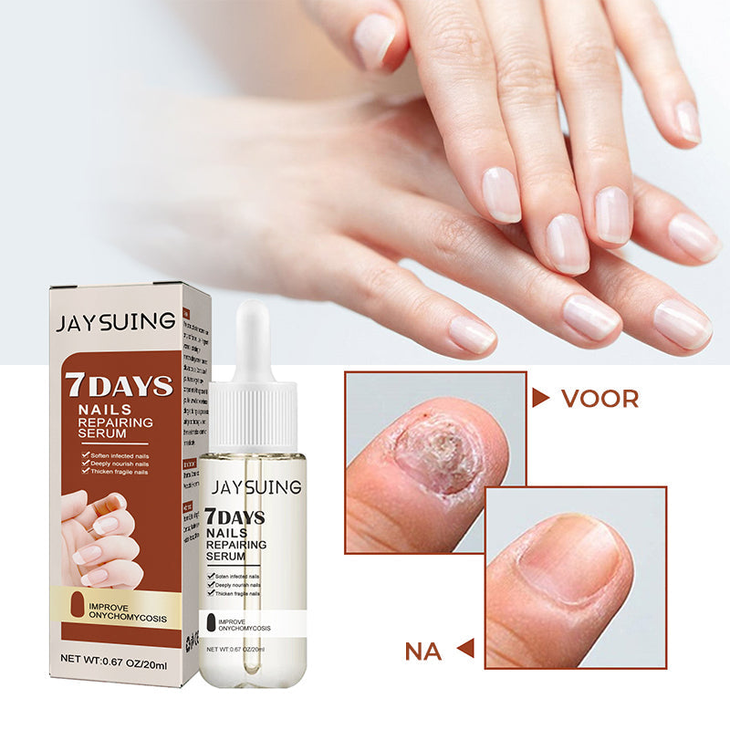 7 dagen nagelgroei en versterkend serum