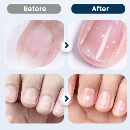 Nagelreparatie- en Versterkingsspray — Hydrateren, Versterken, Glans