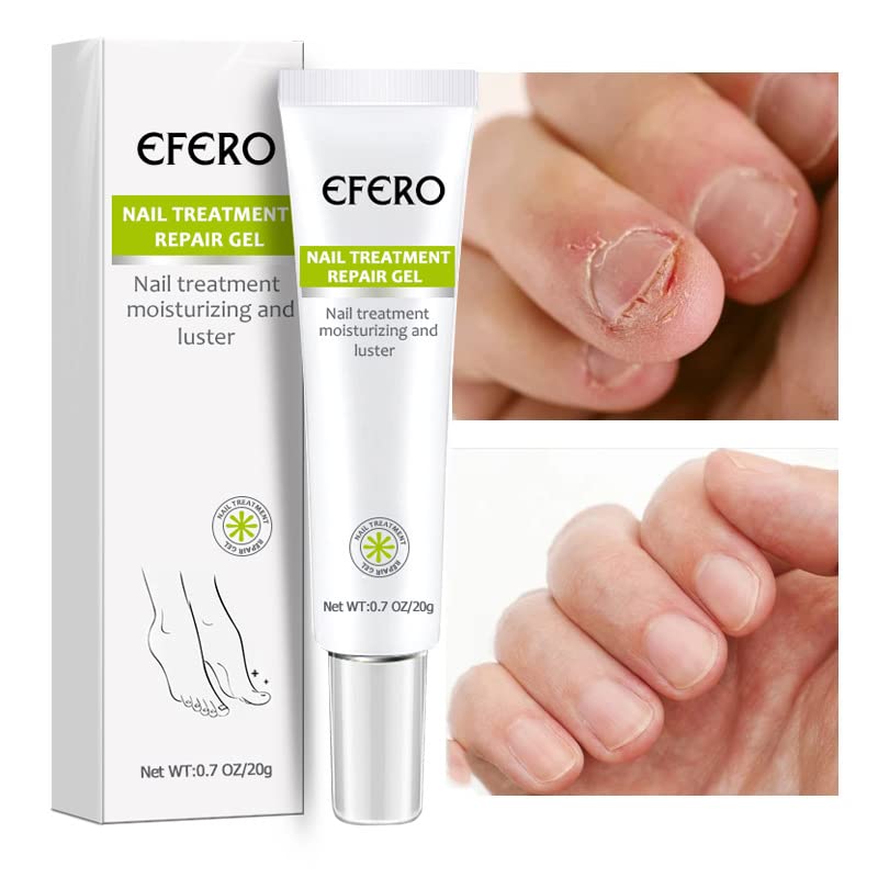 1+1 gratis | Nagelreparatie | Snelle en effectieve resultaten!