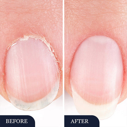 StrongNail – Precisie Nagelverzorging | 1+2 GRATIS