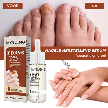 7 dagen nagelgroei en versterkend serum