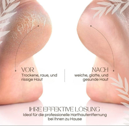 Elektrische eeltverwijderaars | 50% KORTING