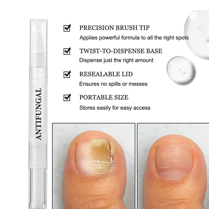 NailRevive – Versterkende Nagelverzorgingspen | 1+1 GRATIS