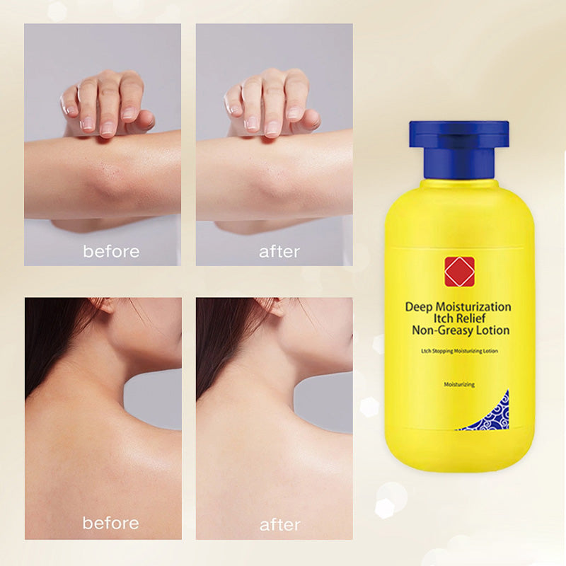 Dermaluxe — Hydraterende Relief Lotion | 1+1 GRATIS