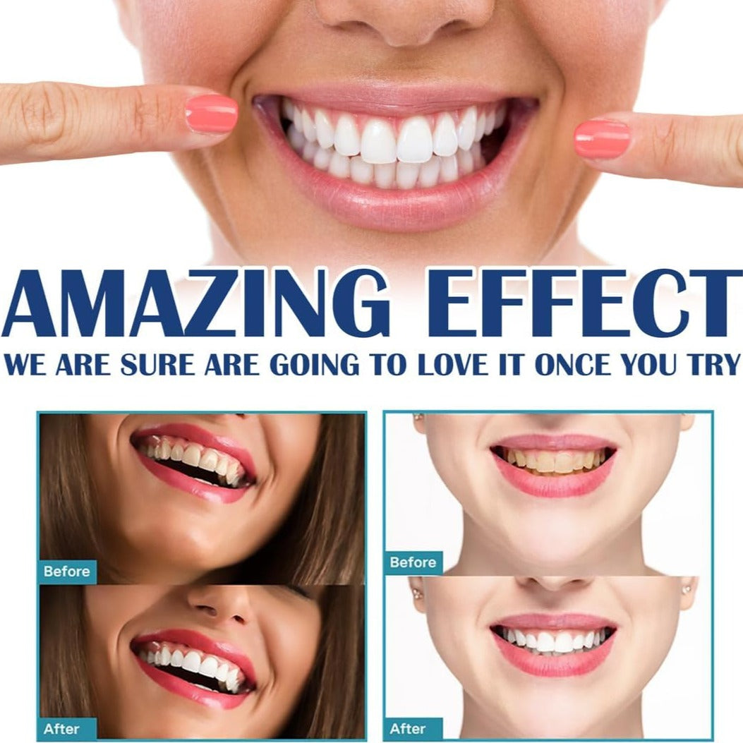 BrightSmile™ Tandenbleekpen | 1+1 GRATIS