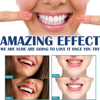 BrightSmile™ Tandenbleekpen | 1+1 GRATIS