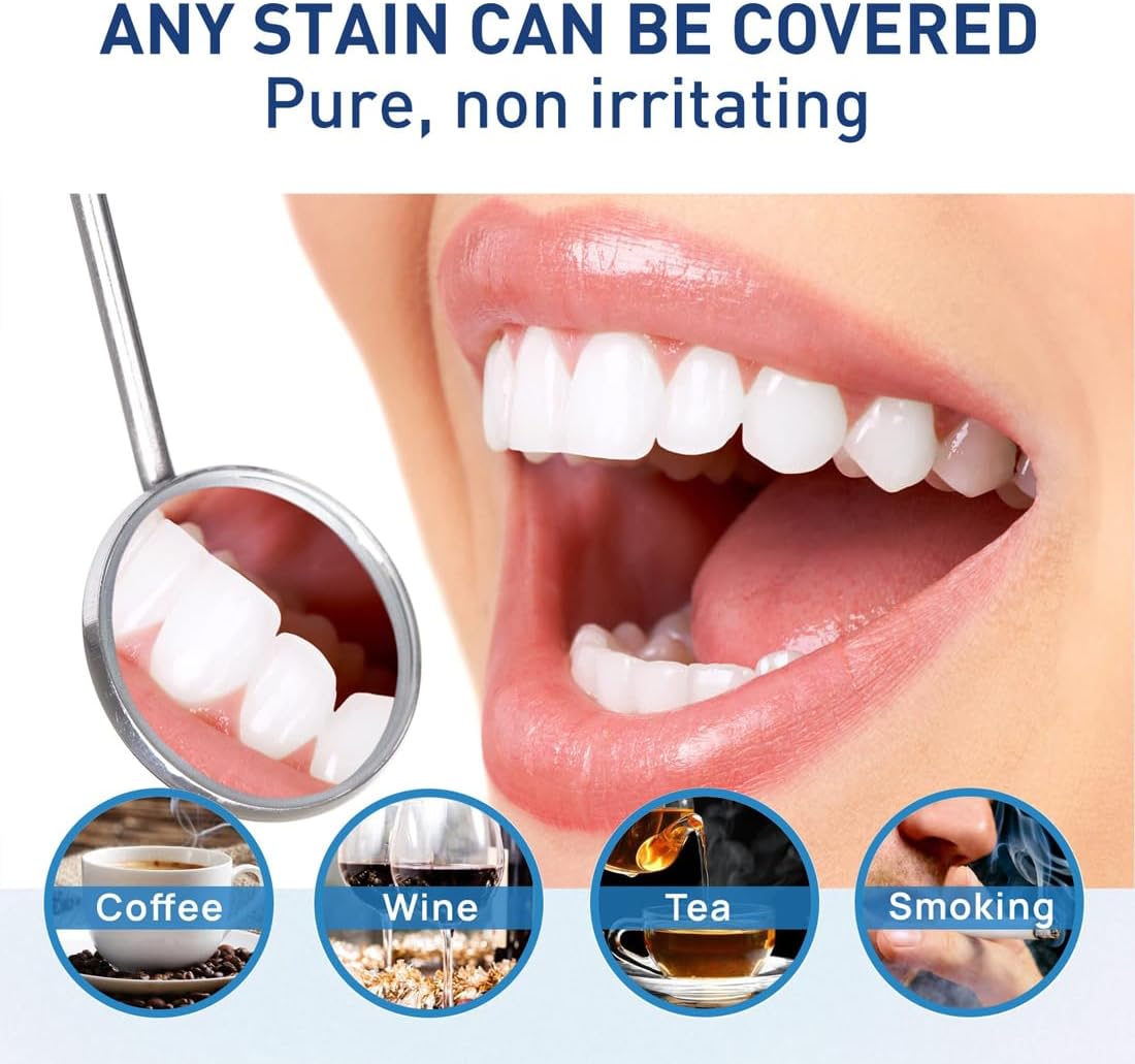 BrightSmile™ Tandenbleekpen | 1+1 GRATIS