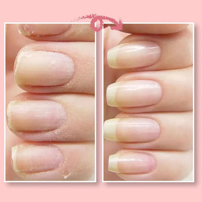 Beschermende gel voor nagelreparatie | 1+1 GRATIS