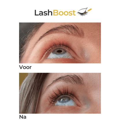 LashBooster ™ | Mooie & Lange Wimpers in enkele seconden| 1+1 GRATIS