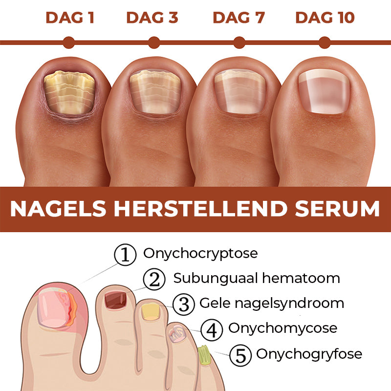 7 dagen nagelgroei en versterkend serum