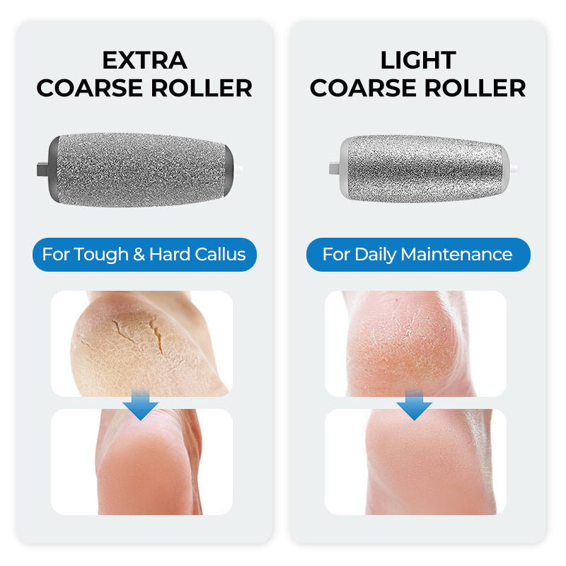 Elektrische eeltverwijderaar voor voeten