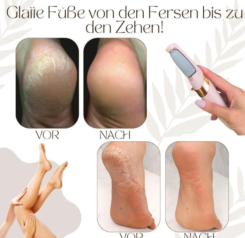 Elektrische eeltverwijderaars | 50% KORTING