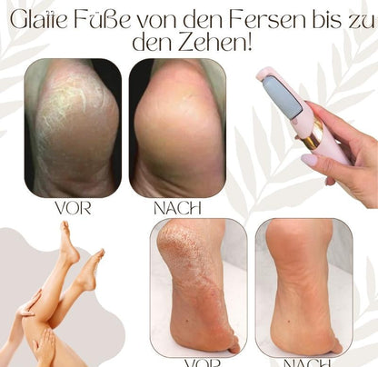 Elektrische eeltverwijderaars | 50% KORTING