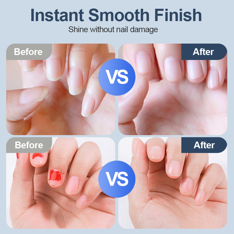 SilentSculpt — Perfecte Nagels Zonder Inspanning