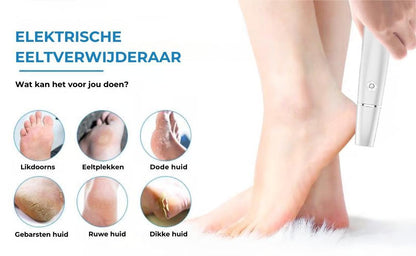 Elektrische eeltverwijderaar 🎁 Inclusief vervangende kop🎁