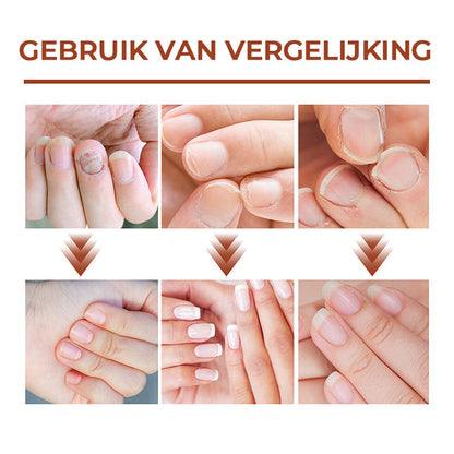 7 dagen nagelgroei en versterkend serum