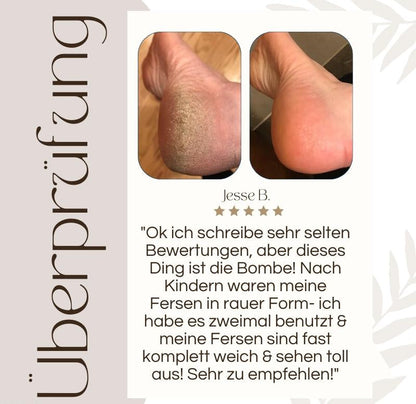 Elektrische eeltverwijderaars | 50% KORTING