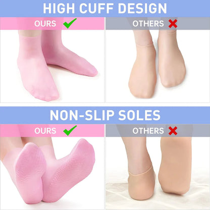 HyperSilk Set 4 paar — Hydraterende Voetsokken | 50% KORTING