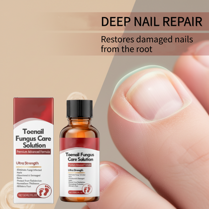 RevitaNail Repair Essence 30ml — Versterkt, Herstelt, Laat Glanzen | Koop 1, Krijg 1 Gratis