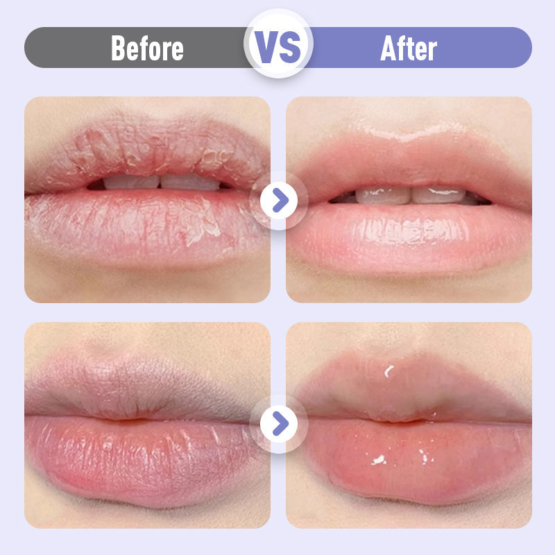 LushVive – Opvullend Lippenserum | 1+1 GRATIS