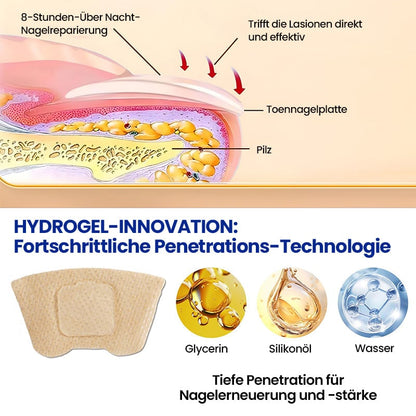 FungiPatch™ 60+60 stuks  – Discrete Behandeling van Schimmelnagels | 50% KORTING