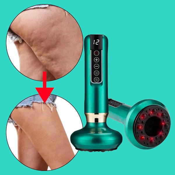 Cupnova – Anti-Cellulite Massager | 50% KORTING