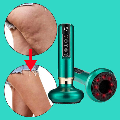 Cupnova – Anti-Cellulite Massager | 50% KORTING
