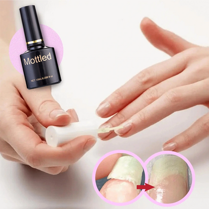 Beschermende gel voor nagelreparatie | 1+1 GRATIS