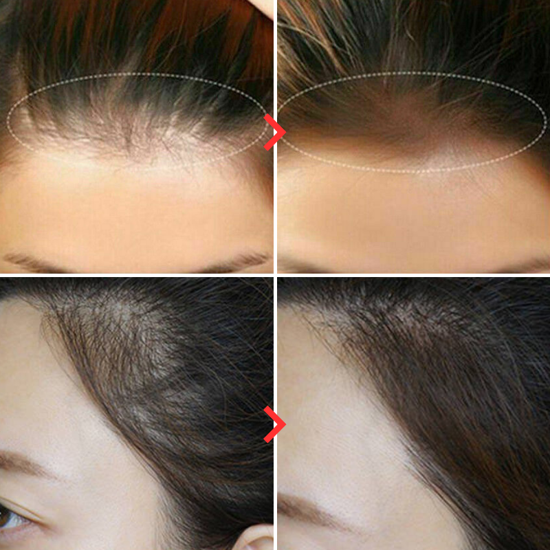 HairFix - Haarvullerpoeder | 1+1 GRATIS