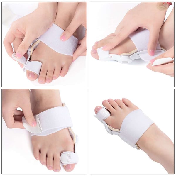 SoleAlign Bunion Oplossing – Dagelijkse Pijnvrije Stappen