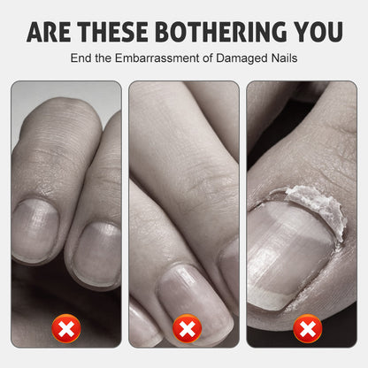 Nagelreparatie- en Versterkingsspray — Hydrateren, Versterken, Glans