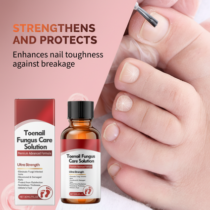 RevitaNail Repair Essence 30ml — Versterkt, Herstelt, Laat Glanzen | Koop 1, Krijg 1 Gratis