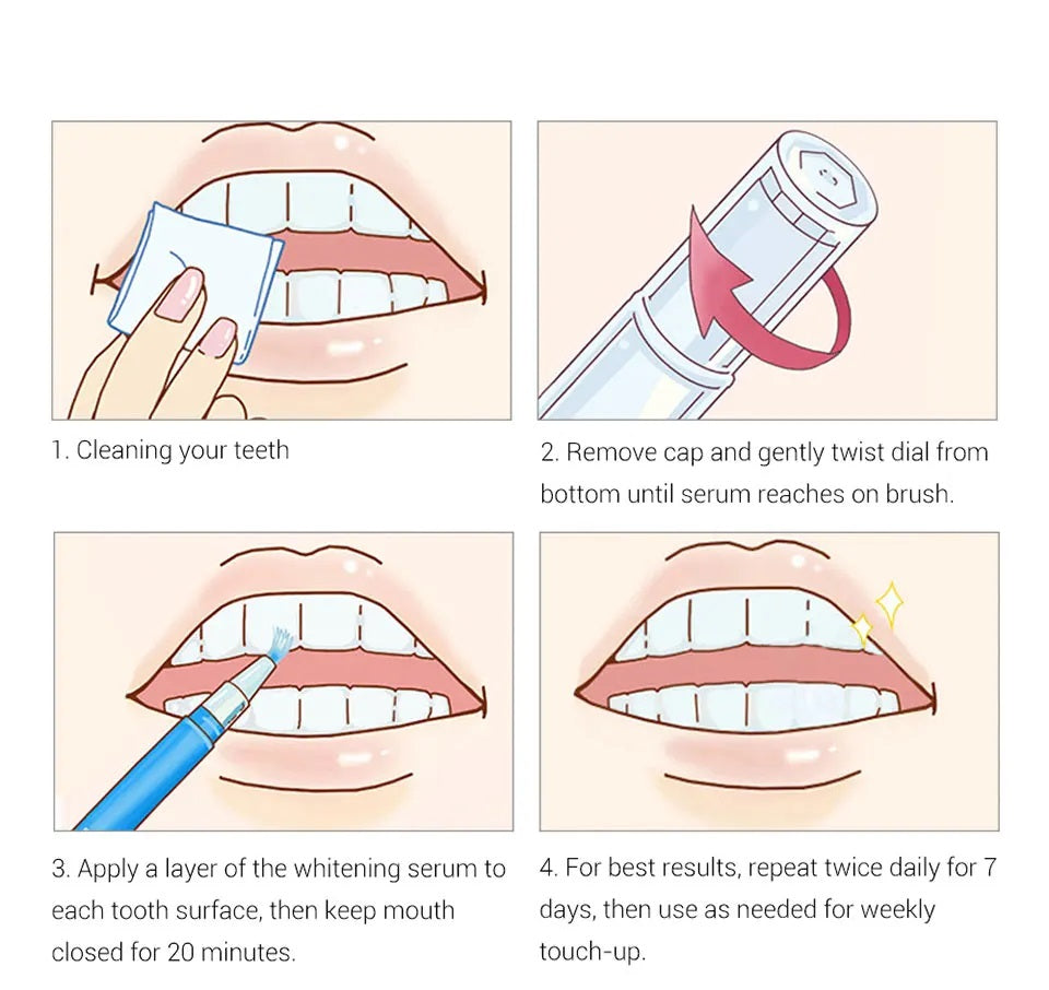 BrightSmile™ Tandenbleekpen | 1+1 GRATIS