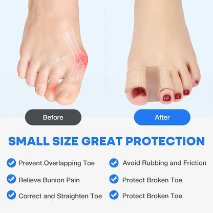 FlexiStep – Zachte teen­correctie | 1+1 GRATIS