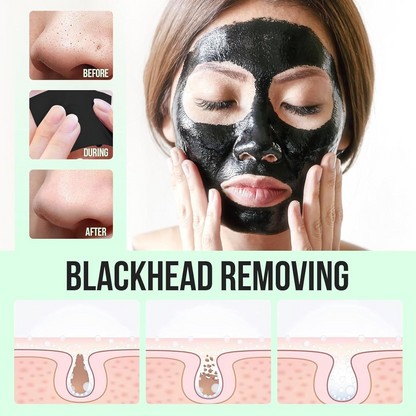 Pureglow 50 ml - mee -eters verwijderd gezichtsmasker | 1+1 gratis