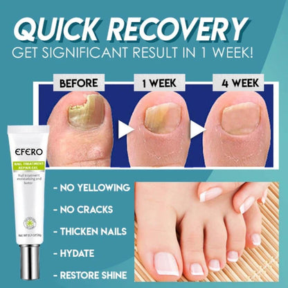 1+1 gratis | Nagelreparatie | Snelle en effectieve resultaten!