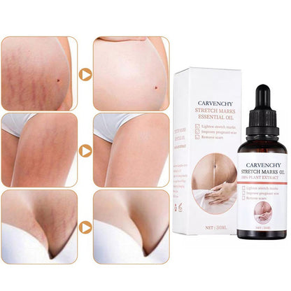 Instant Stretch Mark Olie | 1 + 1 GRATIS